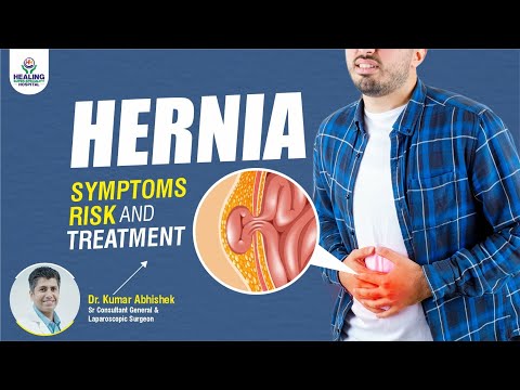 Hernia ALERT! Don't Ignore These Warning Signs!