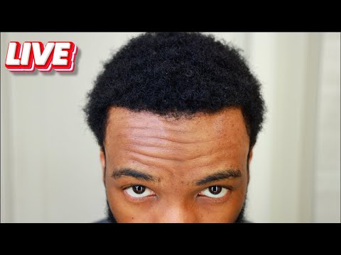 Hair Transplant Week 33 (Live)