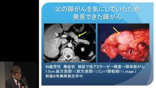 すい臓がん“すい臓がんに対する外科治療の進歩”　中郡 聡夫