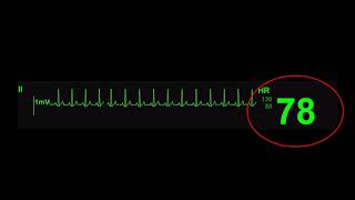 Dynamic Rhythms-1