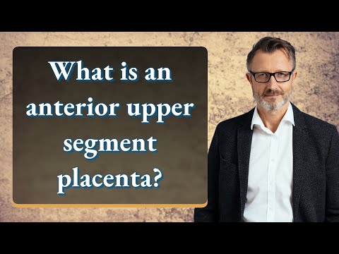 What is an anterior upper segment placenta?