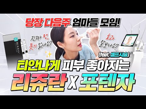 🌸티안나게 피부 좋아지는 [리쥬란X포텐자] 진짜 멍, 붓기 없나요❓ 효과 잘 보나요❓(셀프 시술 리얼 생중계) #40대피부관리 #50대피부관리