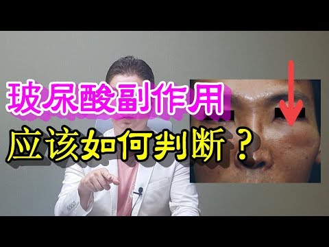 玻尿酸副作用的判斷方法