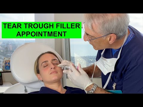 REAL PATIENTS REAL STORIES: Dr. A Gives Bridget Tear Trough Fillers for 'Tired Eyes'