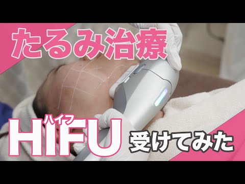 【施術動画】たるみ治療HIFU（ハイフ）を実際に受けてみました！