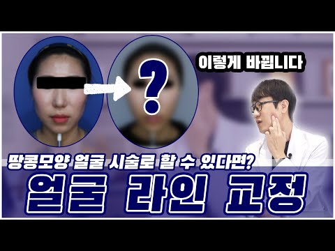 광대부자의 땅콩형 얼굴 ! 작고 매끄러운 얼굴로 만드는 방법 !