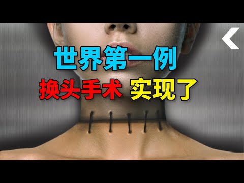 世界第一例“换头”手术实现了，人类什么时候可以随意“换头”？#动物世界 #自然传奇 #大自然 #動物 #動物故事 #野生動物 #動物反殺 #万物有光