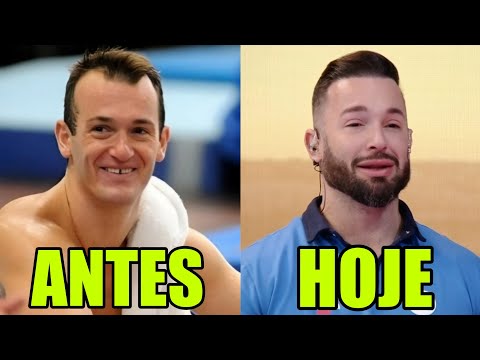 10 FAMOSOS QUE FIZERAM HARMONIZAÇÃO FACIAL e ESTÃO IRRECONHECIVEIS #14