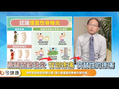 背「硬」如竹竿，僵直性脊椎炎當心6共病找上！口服標靶小分子藥物助早回人生不忍痛！︱feat. 陳瑋昇醫師