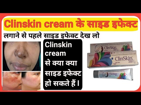 Clin skin cream लगाने से पहले clin skin cream के साइड इफेक्ट देख लो l Side effects of Clin