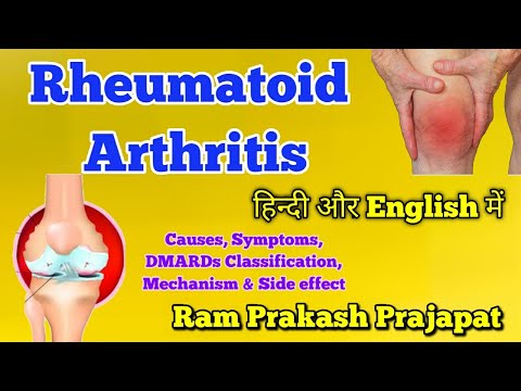 Rheumatoid Arthritis - Causes, Symptoms, Treatment | Pharmacology