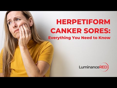 Herpetiform Canker Sores: Everything You Need to Know