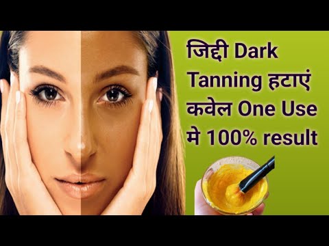 DeTan In One Use :Remove करे जिद्दी काली परत  Sun Tan और पाएं चमकदार Bright Ski..