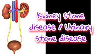 Kidney stone in tamil / Renal stone / Kokiz world