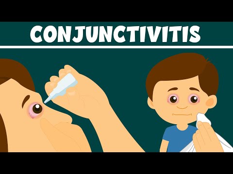 Conjunctivitis: What Is Pink Eye? | Types, Symptoms and Treatment | Video for Kids