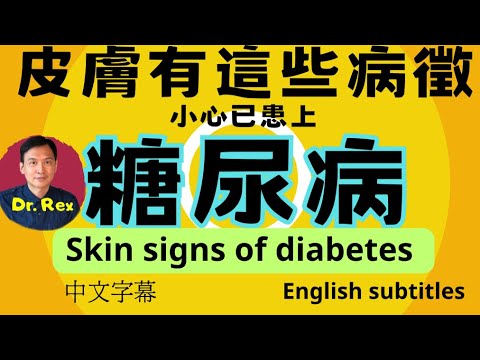 ￼留意這些糖尿病的皮膚徵狀！skin signs of diabetes