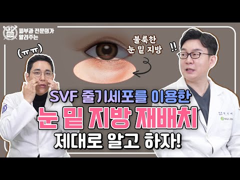 눈밑지방제거와 재배치 효과와 차이점, 제대로 알고 하자! I SVF 줄기세포를 이용한 눈밑지방 재배치