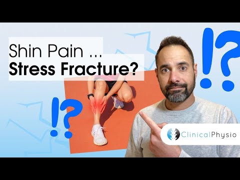 Is Your Shin Pain a Stress Fracture? | Expert Physio Guidance