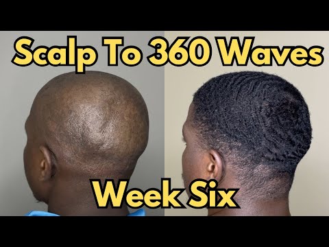 Scalp to 360 Waves - Week 6