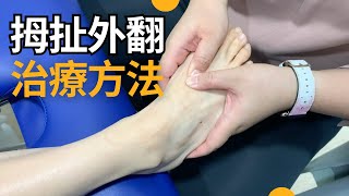 拇指外翻，腳扯公不適物理治療，治療方法 | 梁凱雯 物理治療師 | Together Physio