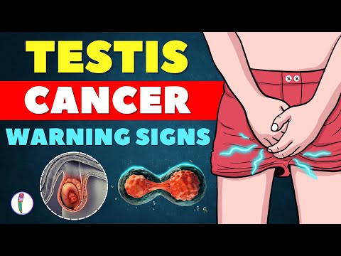 Testicular Cancer Warning Signs You Shouldn't Ignore | Cancer | Testicular Cancer Symptoms