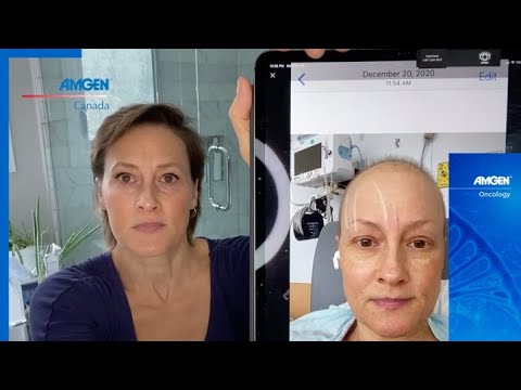 Les gens d’Amgen: Kerry Brennan partage son histoire de cancer du sein