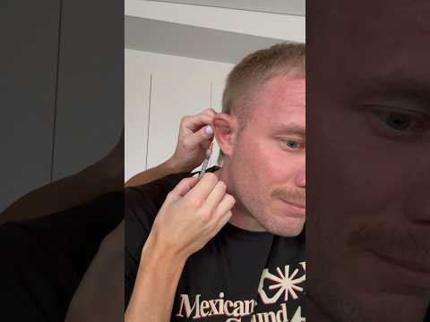 Draining My Cauliflower Ear