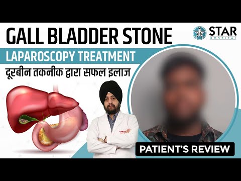 Best Hospital for Gall Bladder Stone in Chandigarh | Best Gall Bladder Doctor | Treatment