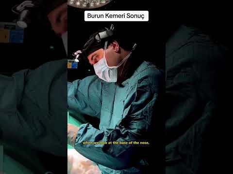 Burun Estetiği Sonucu / Rhinoplasty Results ✨⁠