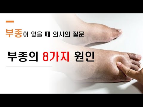 부종의 8가지 원인 #부종원인 #부종이유