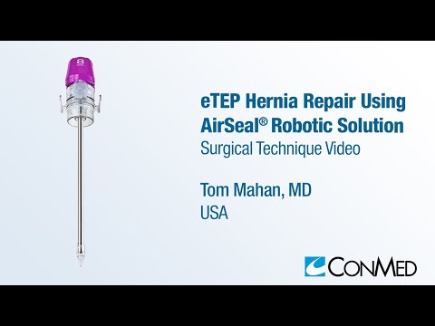 Dr. Tom Mahan - eTEP Hernia Repair Using AirSeal® Robotic Solution - CONMED Surgical Technique