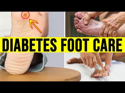 Diabetes Foot Care: 10 Foot Care Tips to Protect Yourself.