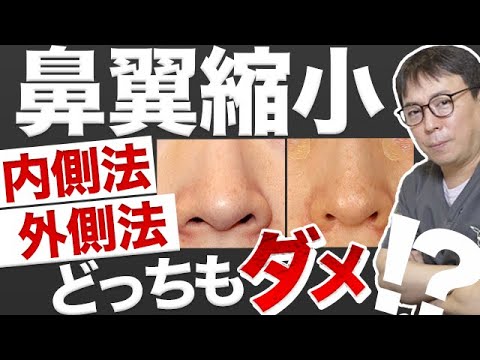 【鼻翼縮小】内側法も外側法もどっちもダメ?!ポイントは〇〇を残すこと!確かにそうだよね！哲院長の目から鱗の縮小方法とは?!