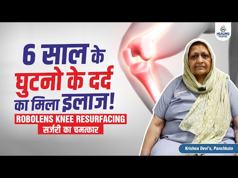 घुटनो का सालों का दर्द हफ्ते में गायब | Patient Review | RoboLens AI Enabled FT-3D Knee Resurfacing