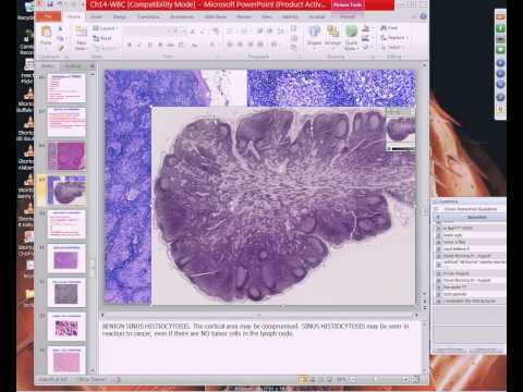 Medical School Pathology, 2013 Season, Session #53: WBC-II