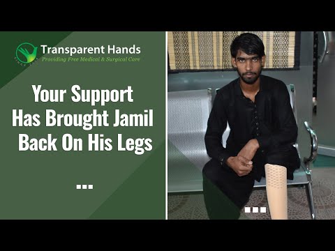 Jamil’s Artificial Leg was Fixed