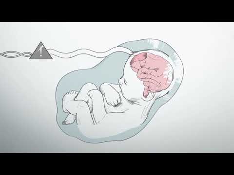 What is hypoxic ischemic encephalopathy?