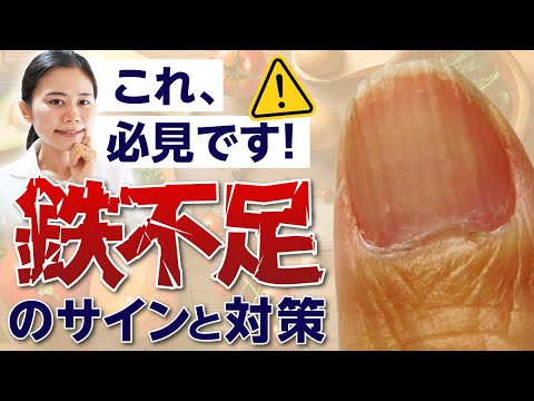 【不調の9割】鉄不足のサイン・お肉・サプリを摂っても治らない理由は〇〇です