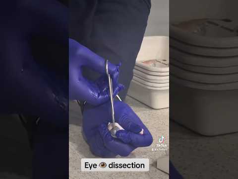 Eye Dissection 👁️ #teacher #teacherlife #eyes #school #education #biology #students #classroom #eye