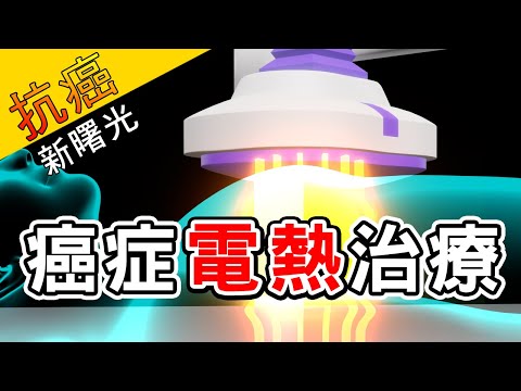 【知情同意】抗癌新曙光-癌症電熱治療 (台語版)