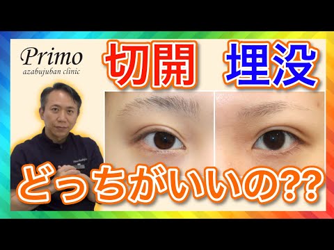 二重切開と埋没何が違うの？失敗しないために知っておきたい★☆目整形・美容整形☆★