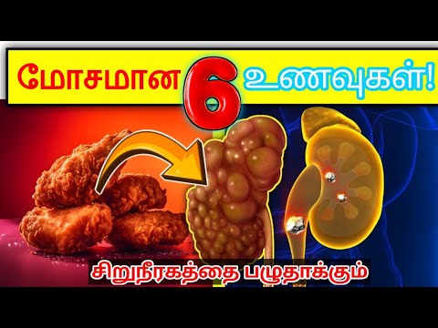 06 மோசமான உணவுகள் சிறுநீரகங்களை பழுதாக்கும்! | 06 Worst foods damage your kidneys | STAR LABORATORY