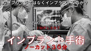 ３０分ノーカット　インプラント治療は失敗しない！怖くない！