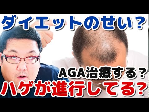 ダイエットでハゲたのか？もともとハゲてた？AGA治療する？