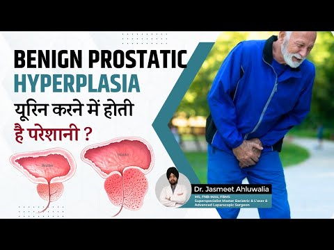 What is Benign Prostatic Hyperplasia (BPH)? Its notes, Causes, Symptoms, Complication & Treatment