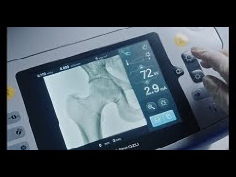 OPESCOPE ACTENO FD type – Fuoroscopy image display on the touch panel