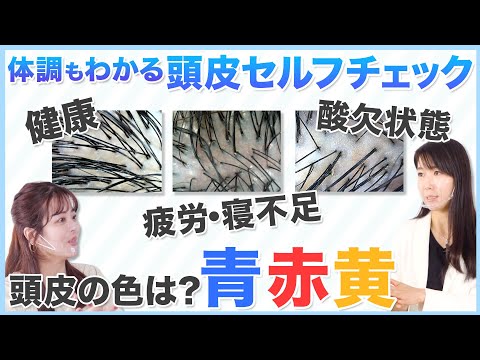 【美髪ヘアケア徹底解説】セルフ頭皮診断で体調がわかる！？カラーリング長持ちは最初の1週間が勝負🔥