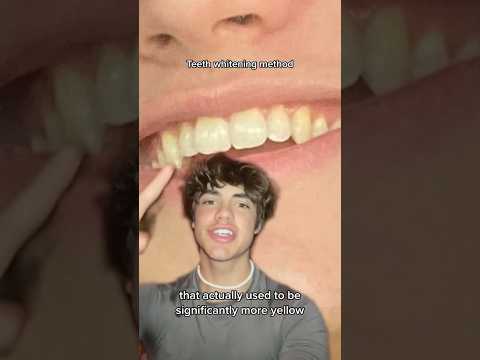 Dentist Reveals SHOCKING Teeth Whitening Secret! 🤫🦷