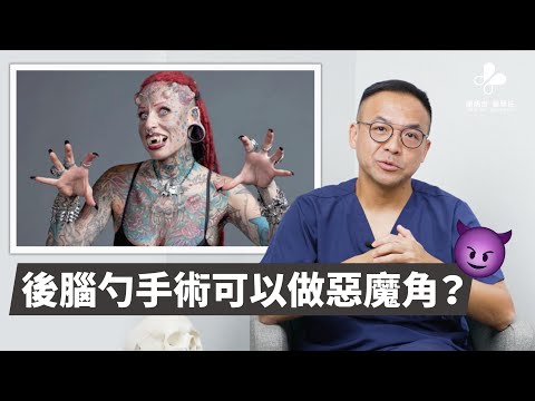 後腦勺填充手術的10個快問快答｜謝明吉醫師