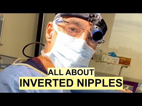 QUICK EXPLANATIONS: What causes INVERTED NIPPLES and how do you correct them?